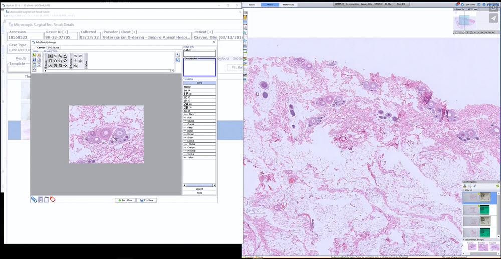 Digital Pathology